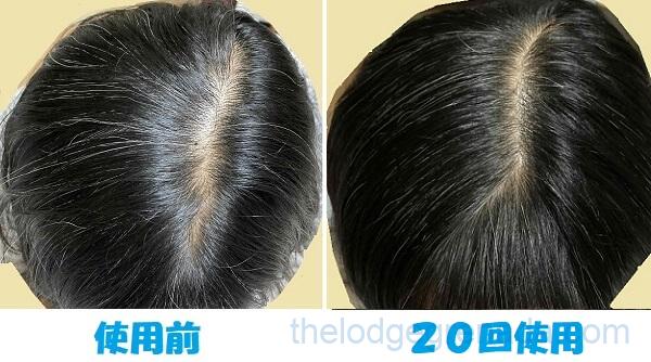 利尻カラーシャンプーを使う前と20回使った後