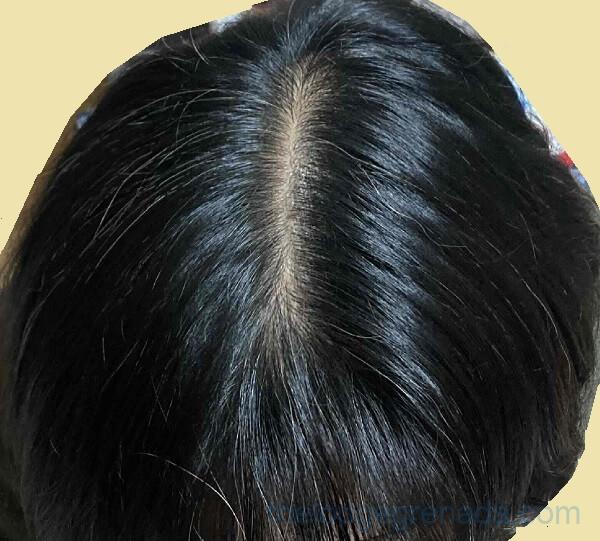 利尻ヘアカラーシャンプー25回目