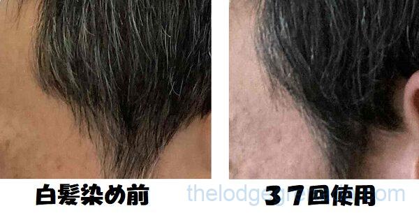 一部に白髪がまとまっている場合