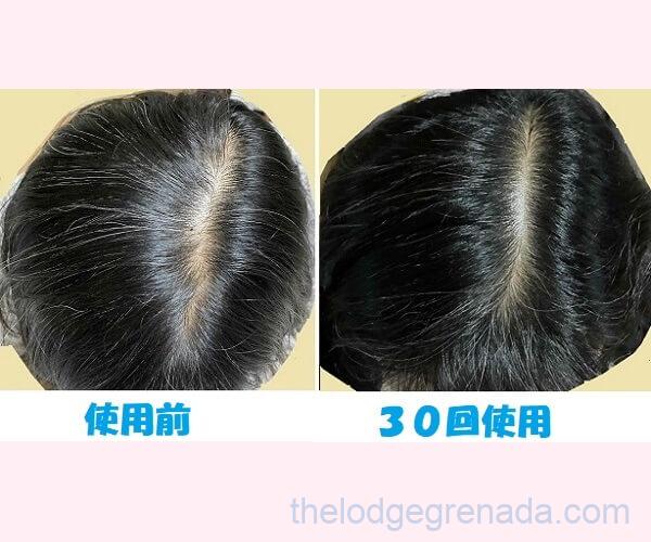 利尻カラーシャンプーの結果