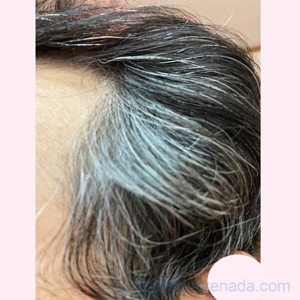 もみあげだけを白髪染めする前