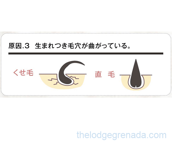 くせ毛の原因3