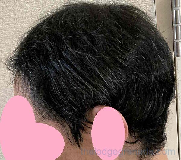 シルクサラン1回目使用後(メンズ)